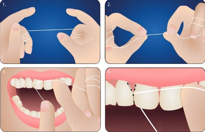 BẠN CÓ ĐANG CHĂM SÓC RĂNG MIỆNG ĐÚNG CÁCH? 4 chăm sóc răng miệng