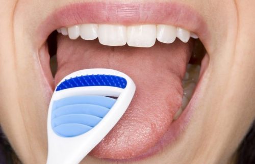 rannienh4 1 7 SAI LẦM NGHIÊM TRỌNG TRONG CÁCH CHĂM SÓC RĂNG MIỆNG HÀNG NGÀY